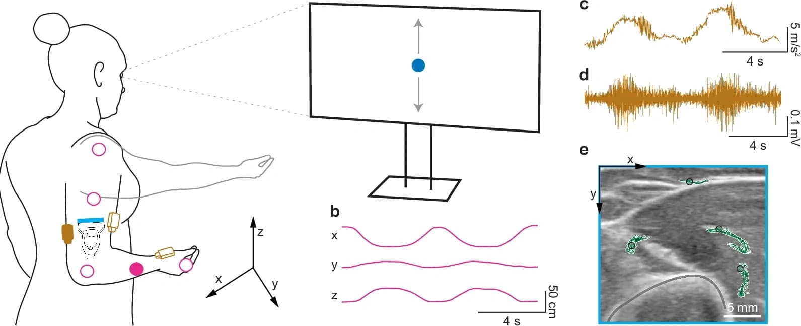 Experimental setup synchronizing reaching motion, ultrasound, motion capture, electromyography, and accelerometry
